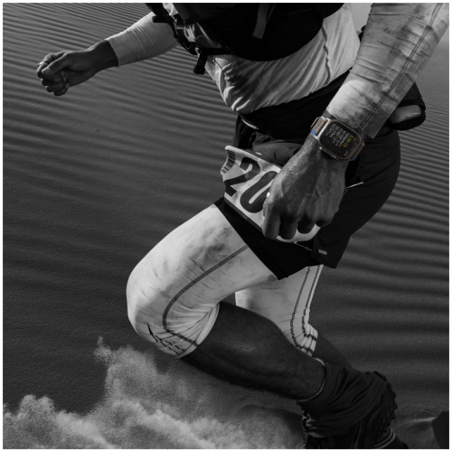 Apple Watch Ultra GPS + Cellular, 49 мм, корпус из титана, ремешок «сияющая звезда», размер L, MQFT3